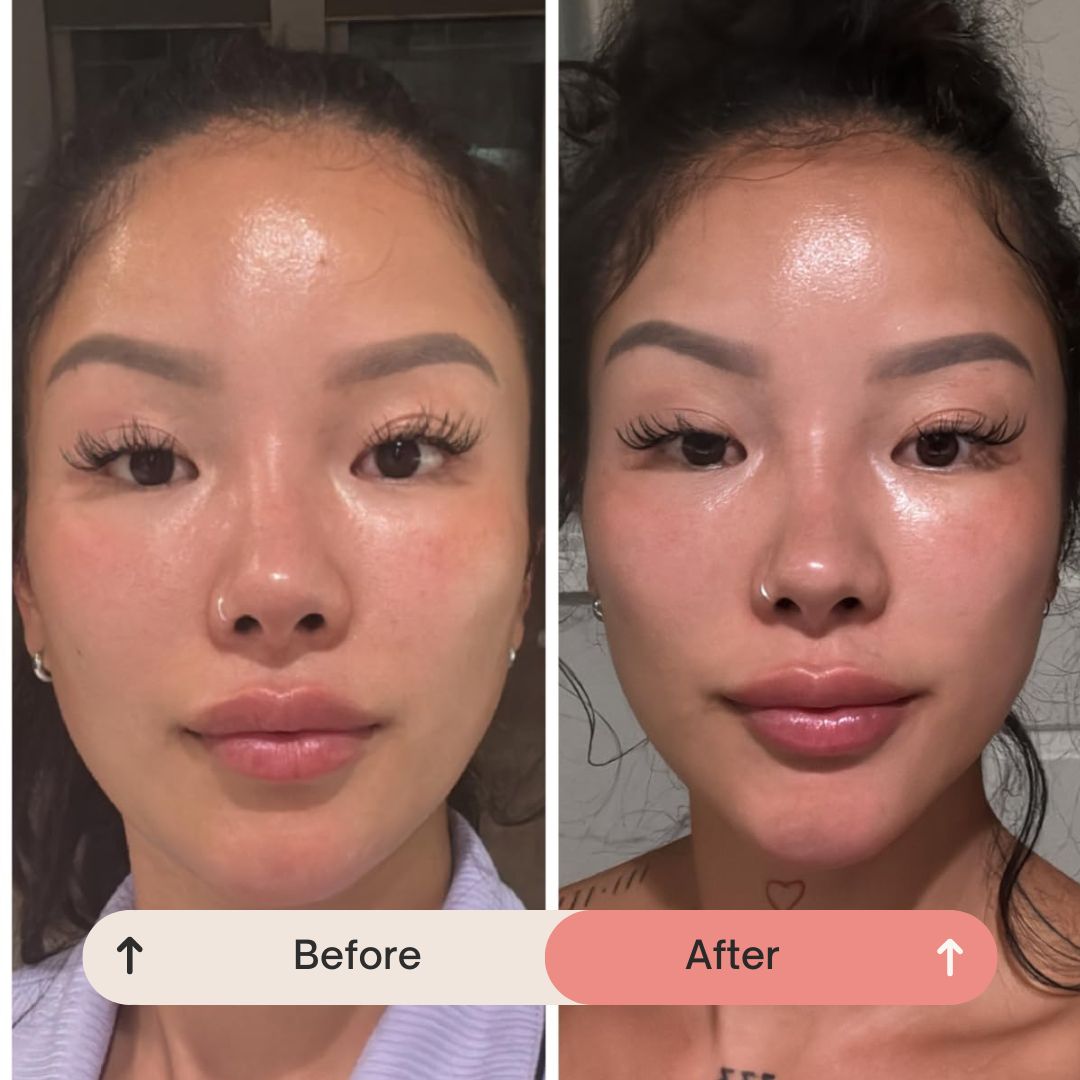 PDRN Cell Renewal Serum