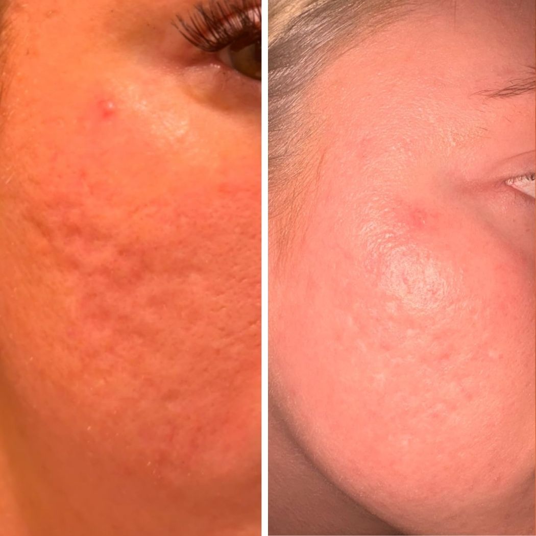 PDRN Skin Repair Serum