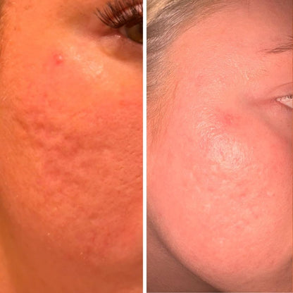 PDRN Skin Repair Serum