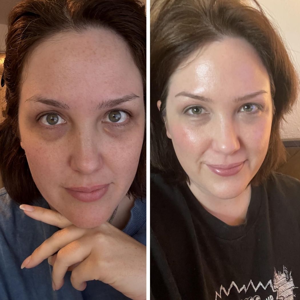 PDRN Skin Repair Serum