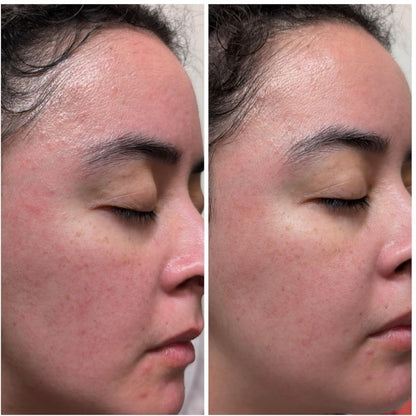 PDRN Skin Repair Serum