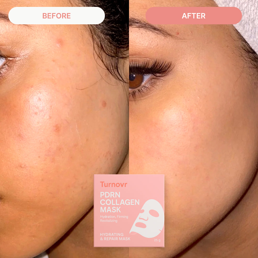 SALMON PDRN COLLAGEN MASK