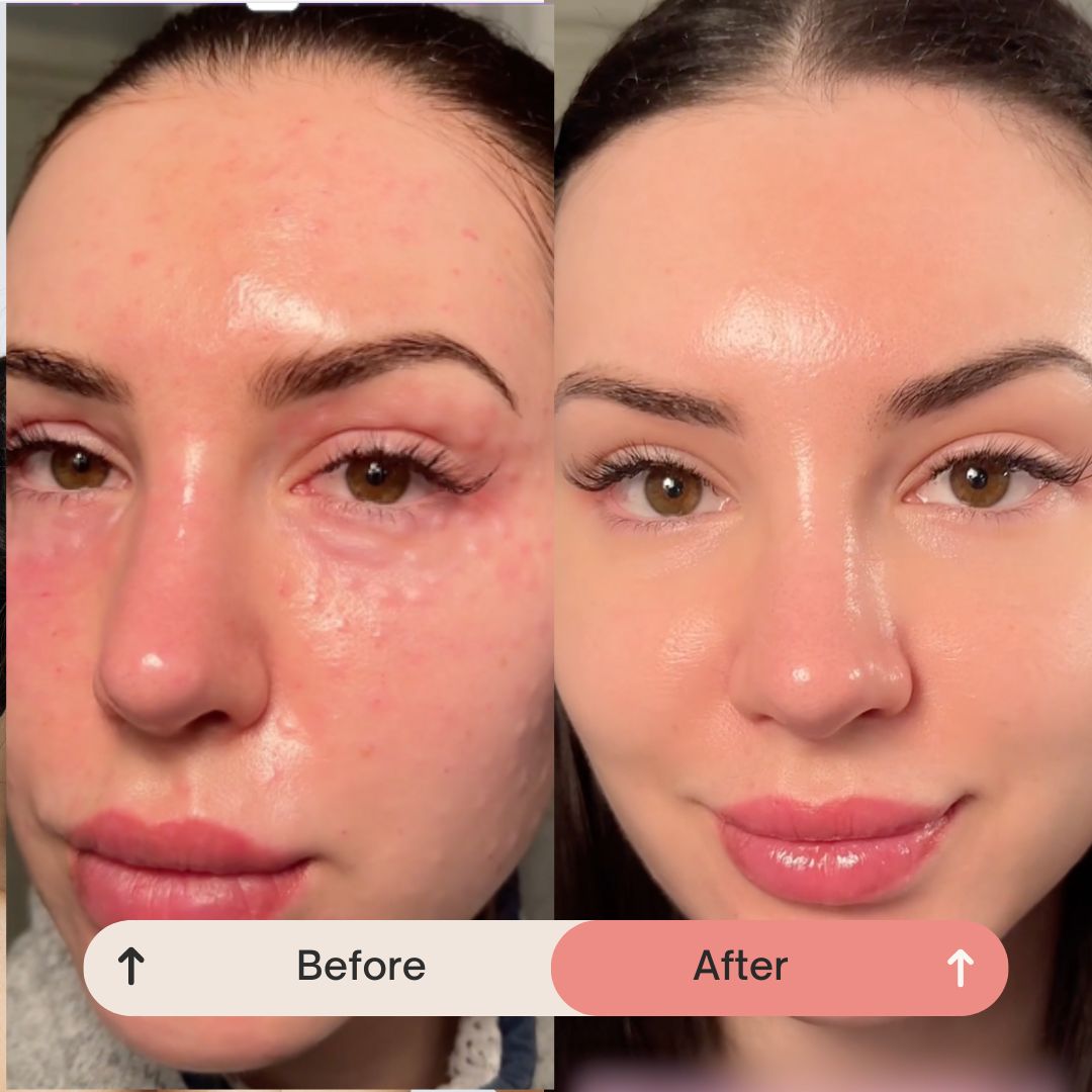 PDRN Cell Renewal Serum
