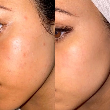 PDRN Cell Renewal Serum